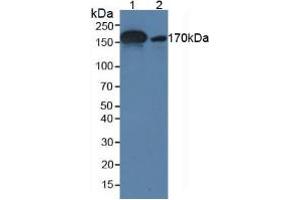 Figure. (alpha 2 Macroglobulin anticorps  (AA 616-856))