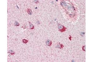 Immunohistochemical analysis of paraffin-embedded human brain, cortex tissues using SORL1 mouse mAb.