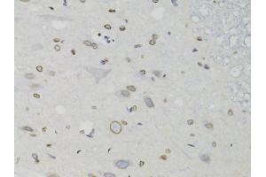 Immunohistochemistry of paraffin-embedded rat spinal cord using LMNB1 antibody (ABIN5970980) at dilution of 1/100 (40x lens). (Lamin B1 anticorps)