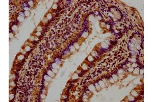 IHC image of ABIN7175232 diluted at 1:100 and staining in paraffin-embedded human small intestine tissue performed on a Leica BondTM system.