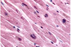 Human Heart (formalin-fixed, paraffin-embedded) stained with CHRM3 antibody ABIN213346 at 10 ug/ml followed by biotinylated goat anti-rabbit IgG secondary antibody ABIN481713, alkaline phosphatase-streptavidin and chromogen.