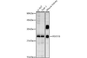 Western blot analysis of extracts of various cell lines, using PEX11B antibody (ABIN7269244) at 1:1000 dilution. (PEX11B anticorps)