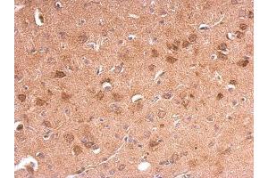 IHC-P Image Adiponectin Receptor 1 antibody [C2C3], C-term detects Adiponectin Receptor 1 protein at membrane on mouse fore brain by immunohistochemical analysis.
