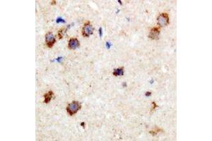 Immunohistochemical analysis of CPI17 (pT38) staining in human brain formalin fixed paraffin embedded tissue section. (CPI-17 anticorps  (N-Term, pSer38))