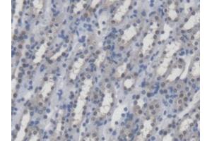 DAB staining on IHC-P; Samples: Mouse Kidney Tissue (UMPS anticorps  (AA 311-481))