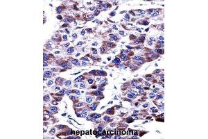 Immunohistochemistry (IHC) image for anti-Dual Specificity Phosphatase 9 (DUSP9) antibody (ABIN2997604)