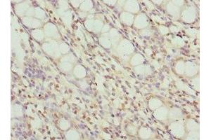 Immunohistochemistry of paraffin-embedded human colon tissue using ABIN7174024 at dilution of 1:100