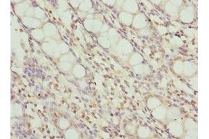 Immunohistochemistry of paraffin-embedded human colon tissue using ABIN7174024 at dilution of 1:100 (FRK anticorps  (AA 1-220))