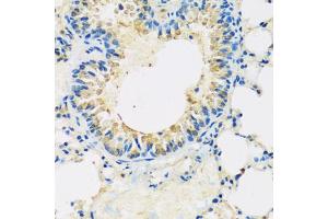 Immunohistochemistry of paraffin-embedded mouse lung using ABCF2 antibody (ABIN5972445) at dilution of 1/100 (40x lens). (ABCF2 anticorps)