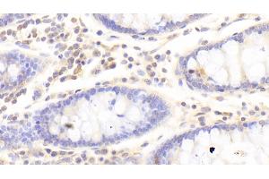 Detection of HPSE in Human Colon Tissue using Polyclonal Antibody to Heparanase (HPSE)