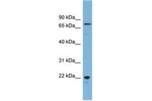 Image no. 1 for anti-Membrane Protein, Palmitoylated 5 (MAGUK P55 Subfamily Member 5) (MPP5) (AA 575-624) antibody (ABIN6742119)