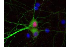 Indirect immunostaining of PFA fixed rat hippocampus neurons with anti-Tbr 1 (dilution 1 : 500; red) and mouse anti-MAP 2 (cat.