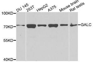 Western blot analysis of extracts of various cell lines, using GALC antibody (ABIN4903732) at 1:1000 dilution. (GALC anticorps)
