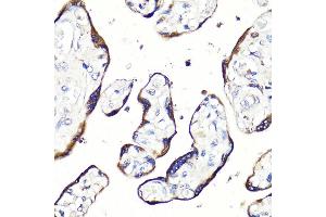 Immunohistochemistry of paraffin-embedded human placenta using HB-EGF antibody (ABIN7267617) at dilution of 1:100 (40x lens). (HBEGF anticorps  (AA 20-160))