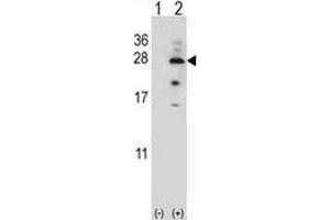 Western blot analysis of IL17B (arrow) using Interleukin-17B / IL17B  Antibody ; 293 cell lysates (2 ug/lane) either nontransfected (Lane 1) or transiently transfected (Lane 2) with the IL17B gene. (IL17B anticorps  (Middle Region))