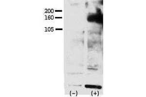 Image no. 1 for anti-V-Erb-A erythroblastic Leukemia Viral Oncogene Homolog 4 (Avian) (ERBB4) (pTyr1162) antibody (ABIN358139) (ERBB4 anticorps  (pTyr1162))