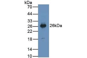 Detection of PTGDS in Human Urine using Monoclonal Antibody to Prostaglandin-H2 D-isomerase (PTGDS)