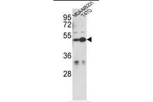 Western blot analysis of CEP55 Antibody (N-term) in MDA-MB231, T47D cell line lysates (35ug/lane). (CEP55 anticorps  (N-Term))