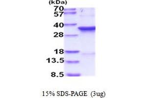 SDS-PAGE (SDS) image for Cyclin-Dependent Kinase 1 (CDK1) (AA 1-297) protein (His tag) (ABIN5854138)