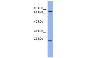 WB Suggested Anti-ZNF530 Antibody Titration:  0. (ZNF530 anticorps  (N-Term))