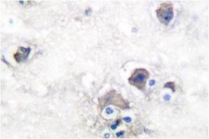 Image no. 2 for anti-Peripherin (PRPH) antibody (ABIN271783) (Peripherin anticorps)