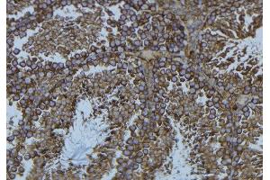 ABIN6276567 at 1/100 staining Mouse testis tissue by IHC-P. (PFN1 anticorps  (C-Term))