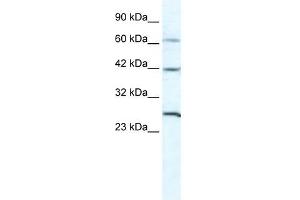 GJC1 antibody used at 5 ug/ml to detect target protein. (GJC1 anticorps  (N-Term))