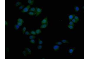 Immunofluorescence staining of Hela cells with ABIN7169724 at 1:50, counter-stained with DAPI. (SIM1 anticorps  (AA 347-434))