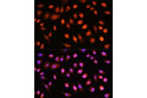 Immunofluorescence analysis of L929 cells using // antibody (ABIN7265520) at dilution of 1:100. (AKT 1/2/3 anticorps)