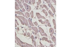 (ABIN6243894 and ABIN6578868) staining MYL1 in human heart tissue sections by Immunohistochemistry (IHC-P - paraformaldehyde-fixed, paraffin-embedded sections).