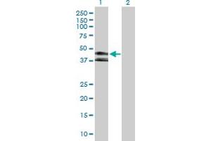 Western Blot analysis of KIR3DL1 expression in transfected 293T cell line by KIR3DL1 MaxPab polyclonal antibody. (KIR3DL1 anticorps  (AA 1-382))