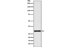 Western blot analysis of VPS24 expression in HepG2 cell lysate.