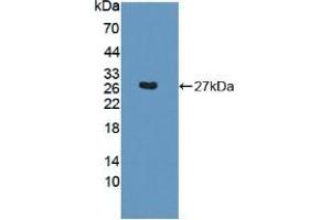 Detection of Recombinant SNAP23, Mouse using Polyclonal Antibody to Synaptosomal Associated Protein 23 kDa (SNAP23)