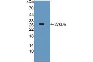 Detection of Recombinant SNAP23, Mouse using Polyclonal Antibody to Synaptosomal Associated Protein 23 kDa (SNAP23) (SNAP23 anticorps  (AA 1-210))