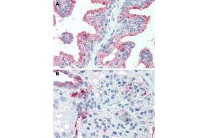 Immunohistochemical staining of human prostate (A) and human kidney (B) with SLC39A14 polyclonal antibody . (SLC39A14 anticorps  (Internal Region))