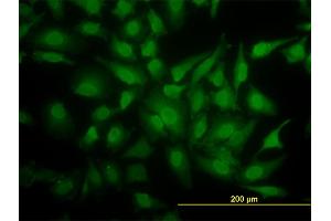 Immunofluorescence of monoclonal antibody to YBX1 on HeLa cell. (YBX1 anticorps  (AA 51-139))