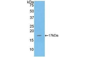 Detection of Recombinant IL16, Human using Polyclonal Antibody to Interleukin 16 (IL16) (IL16 anticorps  (AA 1203-1332))