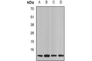 Western blot analysis of Neurokinin B expression in Jurkat (A), mouse spleen (B), rat kindney (C), rat brain (D) whole cell lysates. (Tachykinin 3 anticorps)
