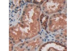 Figure. (HSPB2 anticorps  (AA 12-182))