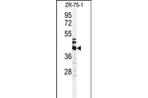 Western blot analysis of KRT35 Antibody (C-term) (ABIN651184 and ABIN2840116) in ZR-75-1 cell line lysates (35 μg/lane). (Keratin 35 anticorps  (C-Term))