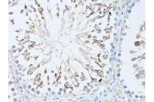Immunohistochemistry of paraffin-embedded rat testis using TEFM antibody (ABIN5974873) at dilution of 1/100 (40x lens). (TEFM anticorps)