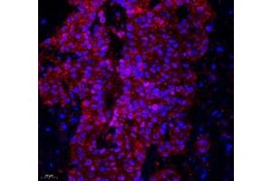 Immunofluorescence of paraffin embedded human colon using Lat (ABIN7074502) at dilution of 1: 2100 (400x lens) (LAT anticorps)