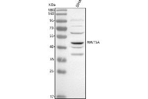 Western blot analysis of WNT5A using anti-WNT5A antibody (ABIN7600456).