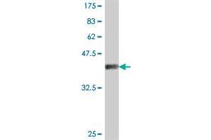 Western Blot detection against Immunogen (37.