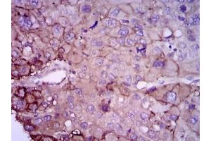 Immunohistochemistry (IHC) image for anti-RAB4A, Member RAS Oncogene Family (RAB4A) antibody (ABIN1108812)