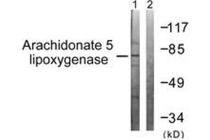 Western blot analysis of extracts from HuvEc cells, using Arachidonate 5 Lipoxygenase (Ab-271) Antibody. (ALOX5 anticorps  (AA 246-295))