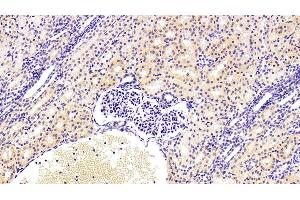 Detection of KMO in Human Kidney Tissue using Polyclonal Antibody to Kynurenine-3-Monooxygenase (KMO) (KMO anticorps  (AA 1-374))