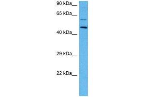 Host:  Mouse  Target Name:  EPOR  Sample Tissue:  Mouse Skeletal Muscle  Antibody Dilution:  1ug/ml (EPOR anticorps  (N-Term))