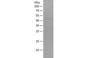 Western Blotting (WB) image for Forkhead Box O6 (Foxo6) (AA 123-342) protein (His-IF2DI Tag) (ABIN7122995)