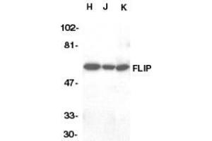 Western blot analysis of FLIP in HeLa (H), Jurkat (J), and K562 (K) whole cell lysate with AP30342PU-N FLIP antibody at 1/1000 dilution. (FLIP anticorps  (C-Term))